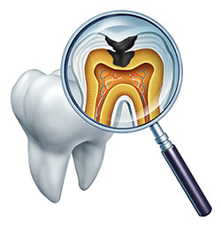 The image features a magnified view of a tooth with an open crown, showing the interior structure including the pulp chamber and root canal system, with an X-ray film overlaying the tooth to illustrate its internal anatomy.