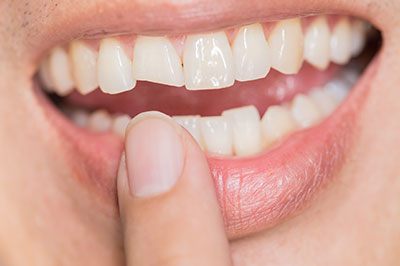 The image shows a person with an open mouth, revealing teeth, holding a finger near their lips, and appears to be smiling or laughing.