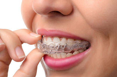 Woman wearing clear braces with her fingers while smiling at the camera.